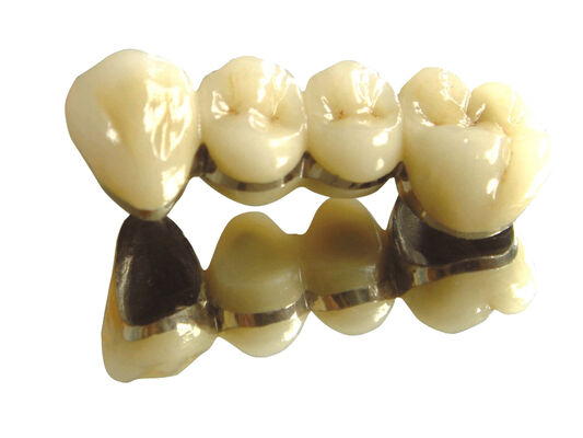 Semi Precious Alloy Metal Crown And Bridge Tooth Temporary Crown