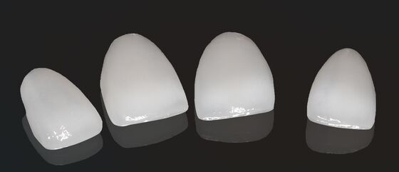 High Esthetics Composite Crown Onlay Veneer Customizable Size