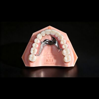Good price High Strength Titanium Crown And Bridge Coping With Composite online