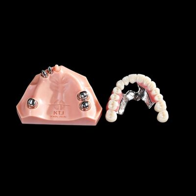 Good price Telescope Metal Crown And Bridge For Dental And Orthodontic online