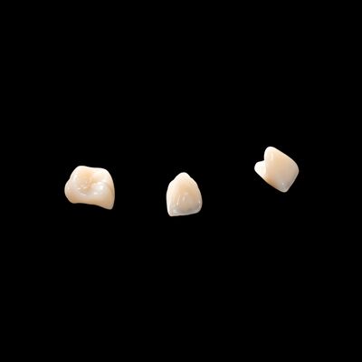Good price Customized Dental Temporary Crown PMMA Temporary Bridge And Crown online