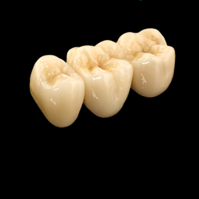 Good price Yellow Metal Crown And Bridge Precious Alloy Crown Bridge Customizable online