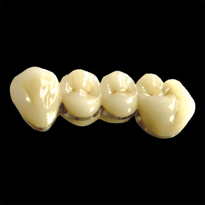 Good price Metallic / Natural Ti Base Crown Post Core Titanium Crowns For Teeth online